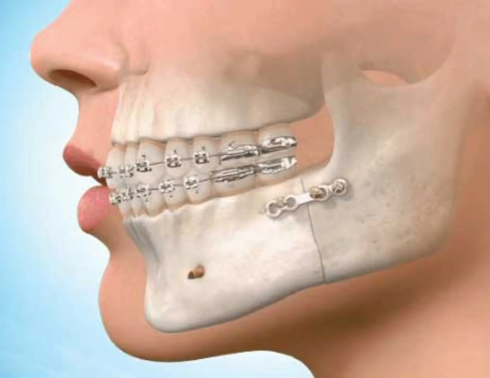 TMJ / TMD Treatment