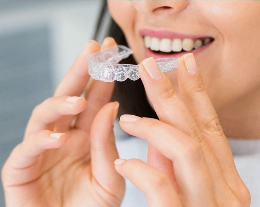 Clear aligner treatment
