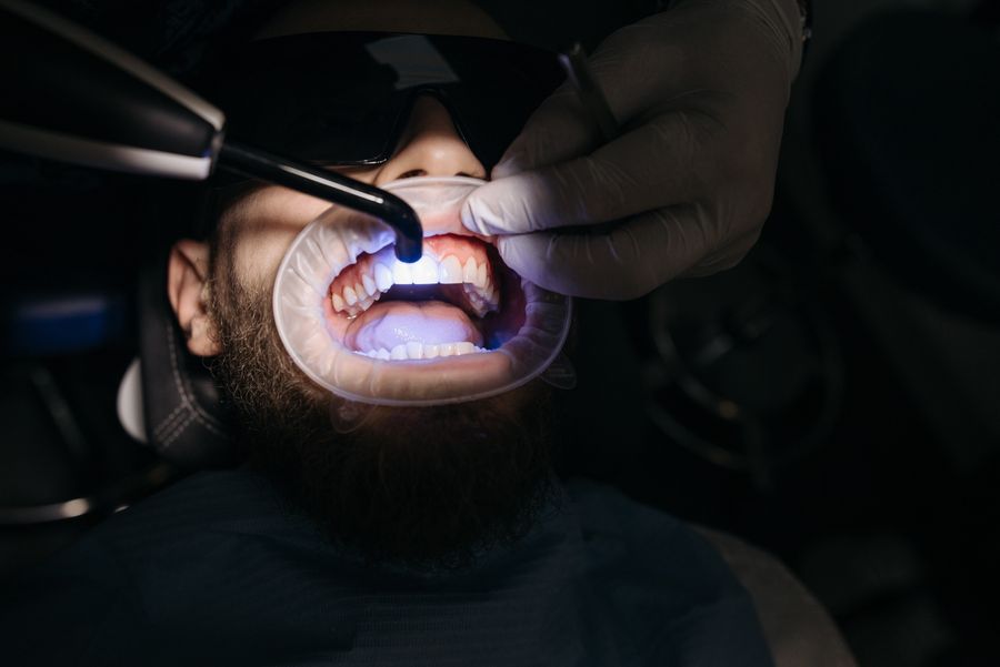 Laser gum contouring