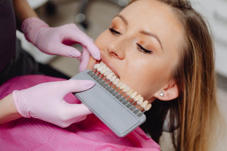 Professional teeth whitening