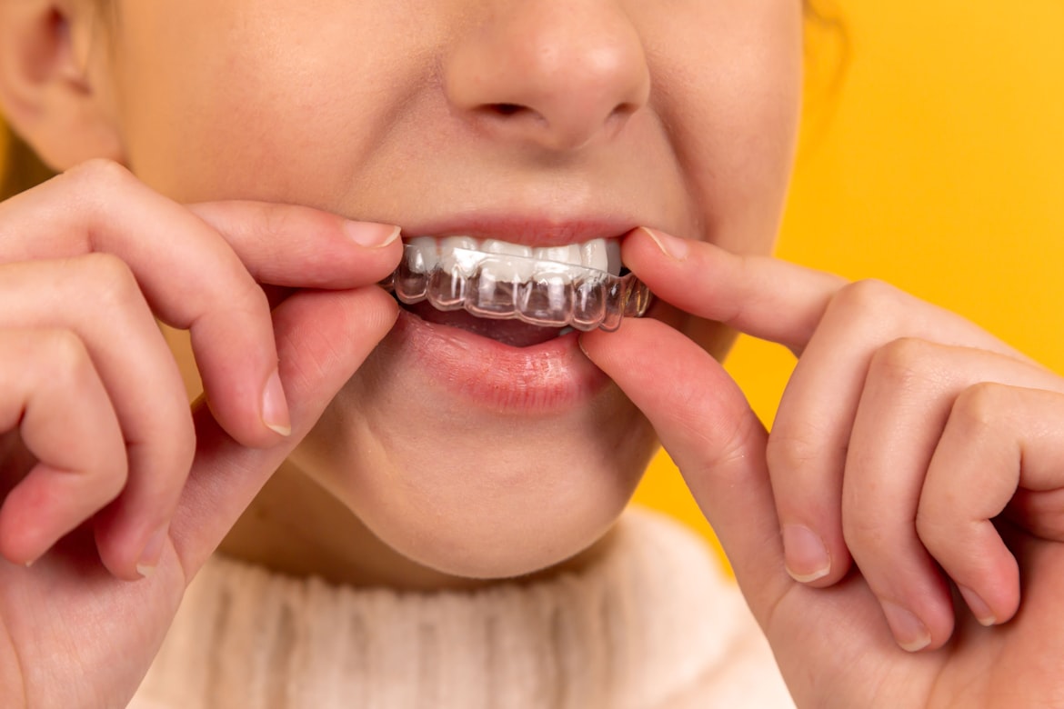 A clear aligner tray