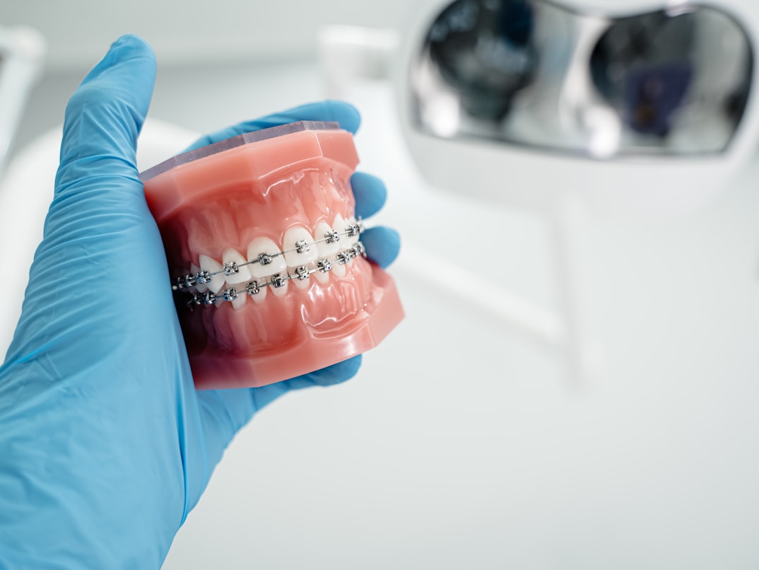 Metal braces on a dental model