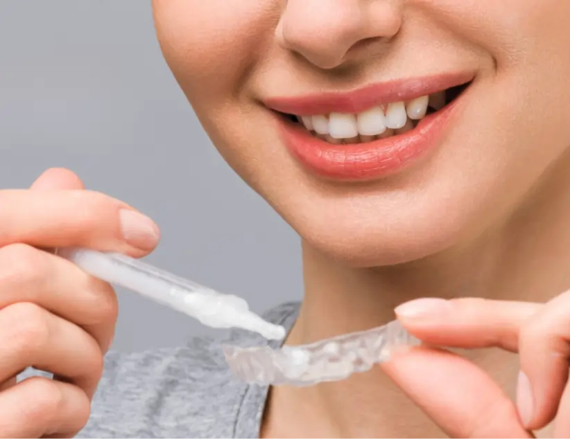 At-home Zoom whitening kit