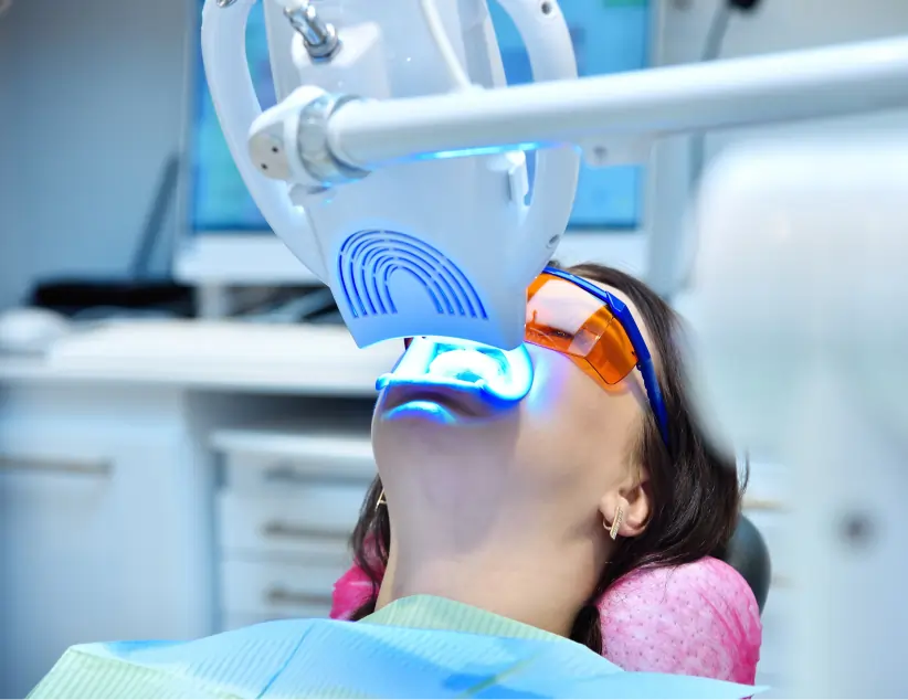 In-office Zoom whitening treatment